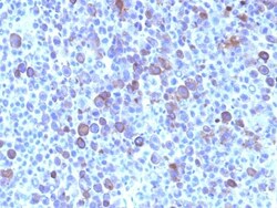 Glypican 3 Antibody (SPM595), Novus Biologicals 0.2 mg | Buy Online | Novus Biologicals | Fisher Scientific